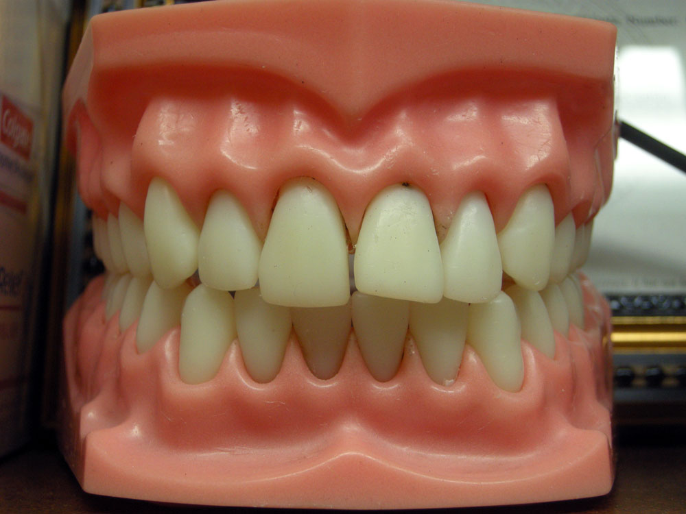 Fake teeth on the counter at Dr. Miraglia's office in Rochester, New York